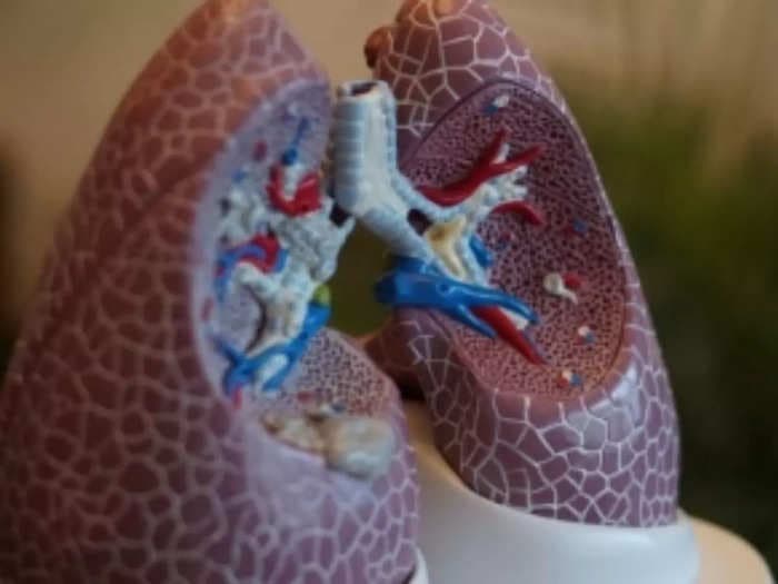 World Lung Cancer Day: Rise of disease among non-smokers a concern
