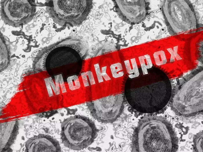 Top 10 countries with the highest number of Monkeypox cases