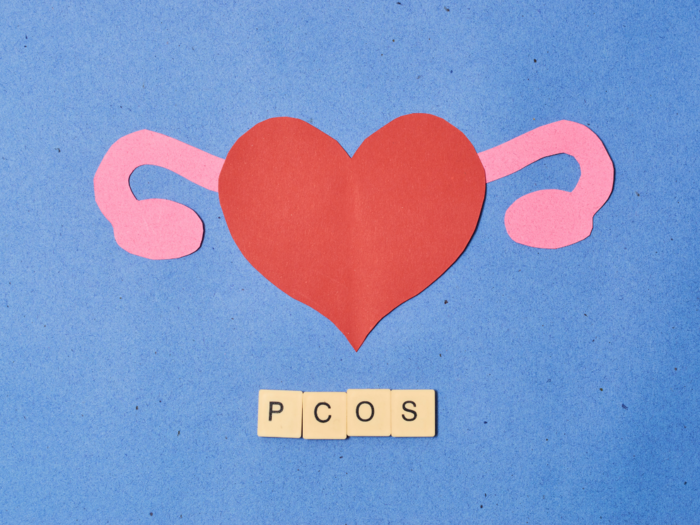 Weight gain during the pandemic is increasing the incidence of PCOS in women
