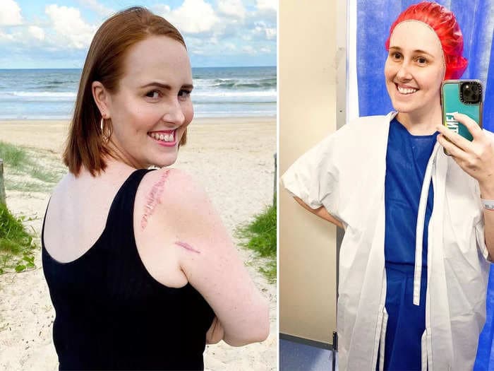 A 29-year-old woman thought she wouldn't get skin cancer because she could tan. A mole on her shoulder was aggressive cancer that spread to her bowel and thigh.