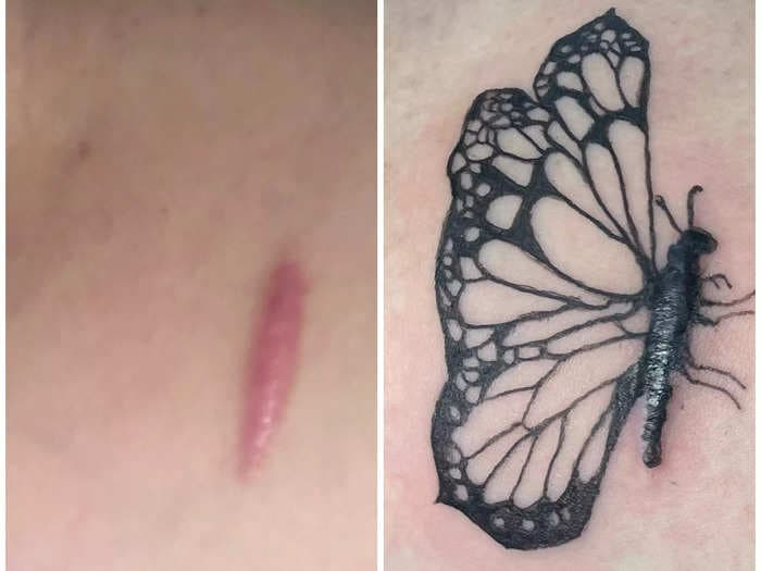 People are getting tattoos to hide scars from surgeries and self-harm. A tattoo artist says they change her clients' lives.