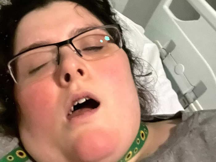 Woman with a rare brain disease says doctors repeatedly dismissed her condition, blaming it on mental illness