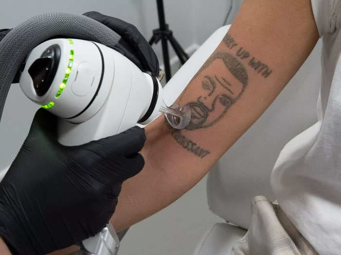 'Yeezy come, Yeezy go': Kanye West tattoos are being removed for free by a studio in London