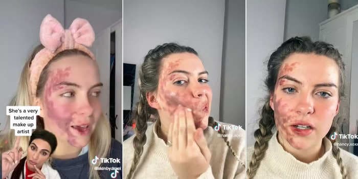 A TikTok-famous doctor is under fire after suggesting a woman had faked a skin condition in a viral video