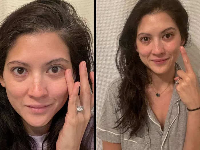 I tried 5 of TikTok's top hacks for getting rid of dark under eye circles. Here's what works best.