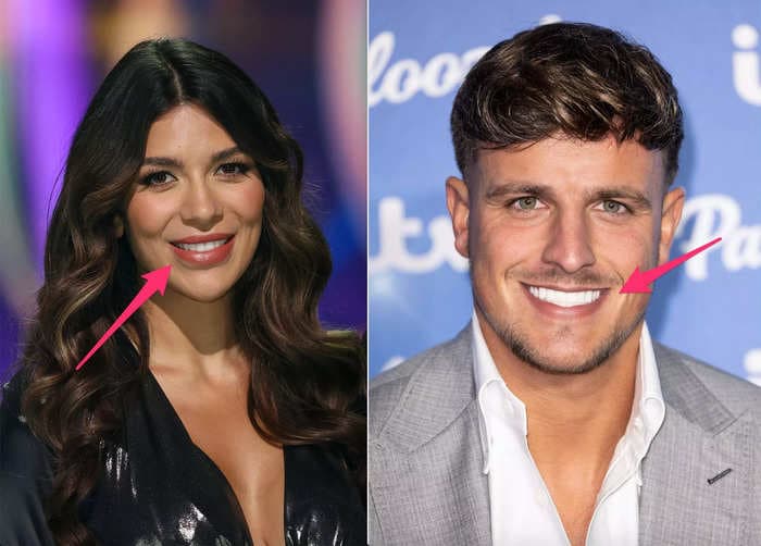 A dentist says the 'Love Island smile' may look dazzling, but could cause your teeth to rot in 20 years