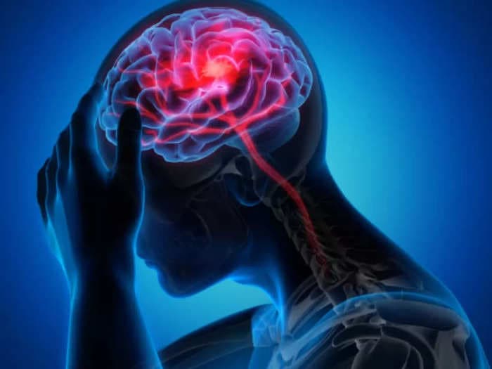 One patient succumbs to brain stroke every four minutes in India says expert