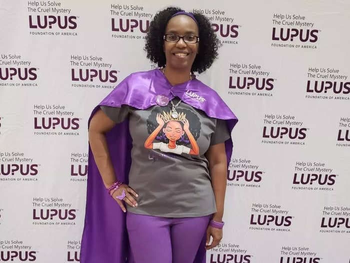 It took me 19 years and 12 doctors to finally get diagnosed with lupus. No one seemed to care enough about my pain.