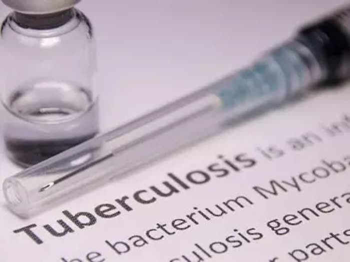 World Tuberculosis Day: India's goal to be Tuberculosis-free by 2025 ambitious but achievable, say experts