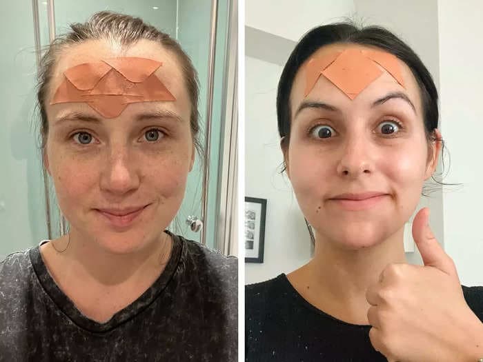 We tried face taping, a Botox alternative, to smooth wrinkles. It worked like magic — for a few hours.