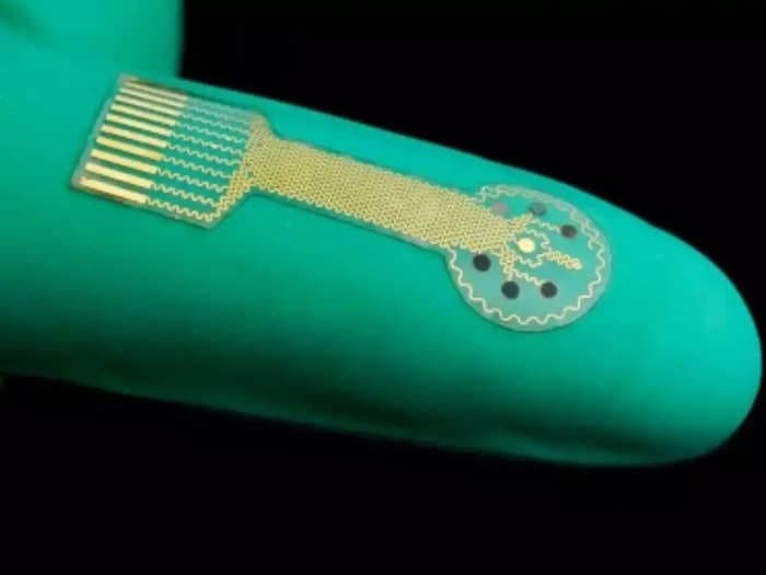 Smart bandages with biosensors to help heal chronic diabetic wounds