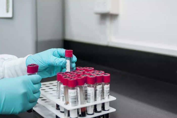 Ipca Laboratories to acquire 33 pc stake in Unichem for 1,034 crore