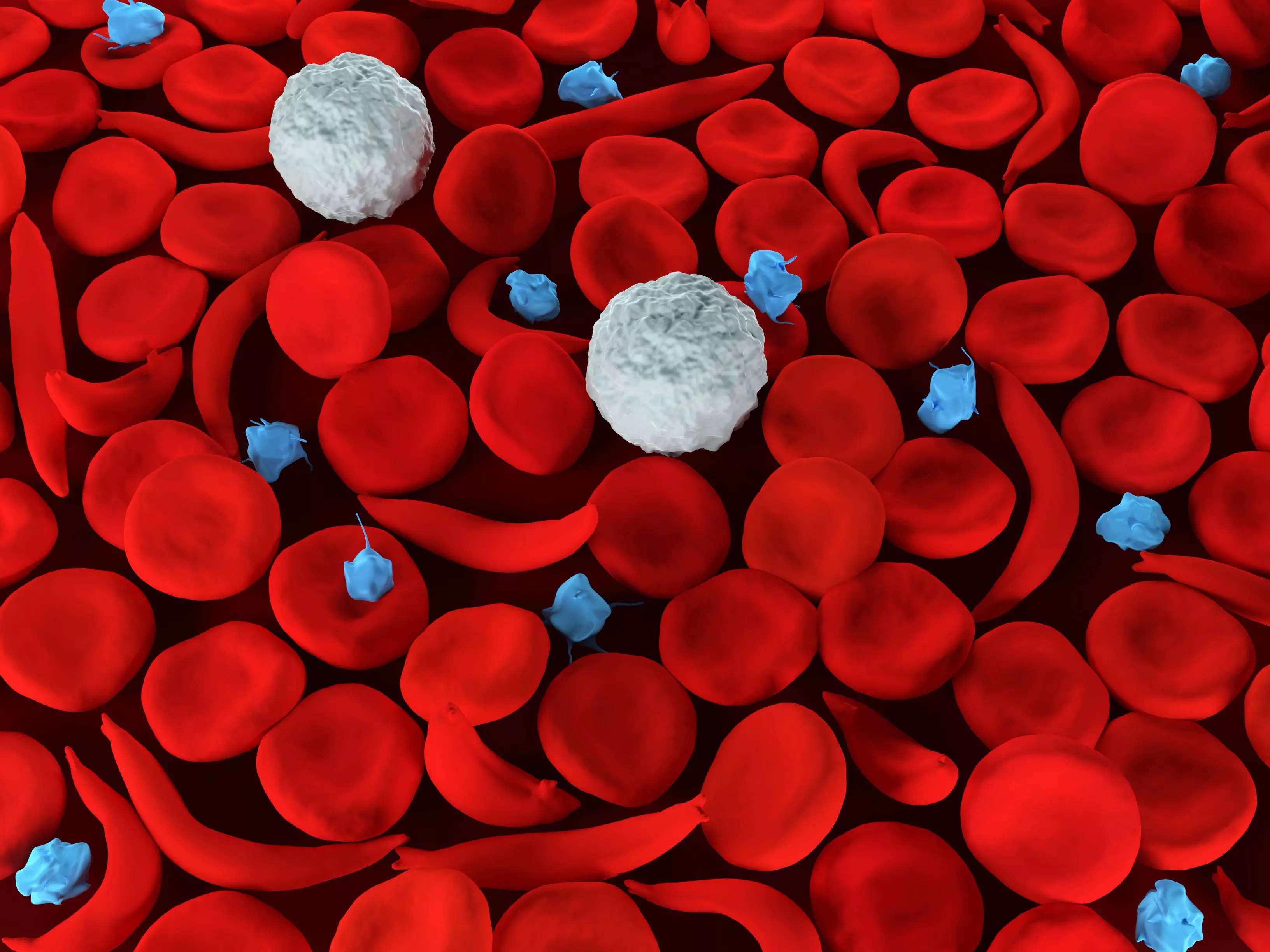 the-fda-just-approved-the-first-gene-editing-therapy-for-sickle-cell