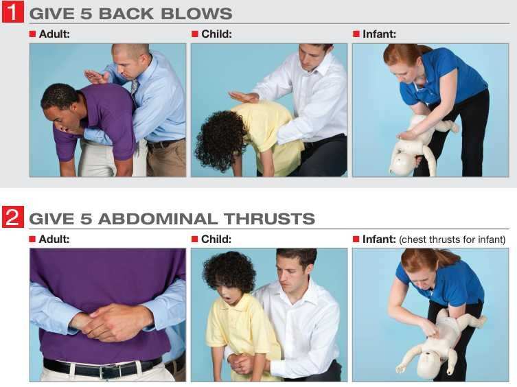 dr-heimlich-is-horrified-by-the-red-cross-protocol-for-saving-choking