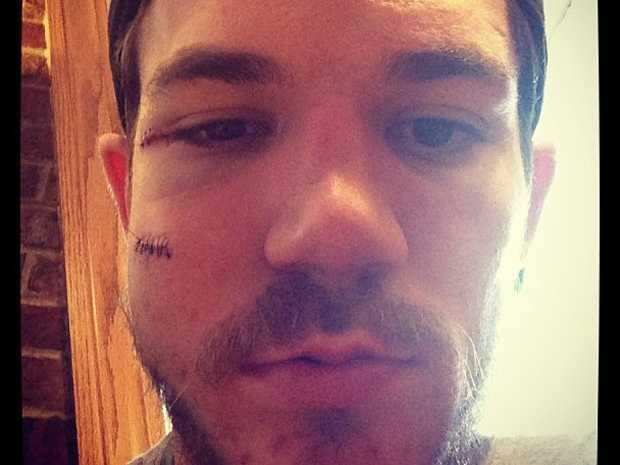 Andrew Shaw's stitches from Stanley Cup celebration sell for $6,500 at  auction