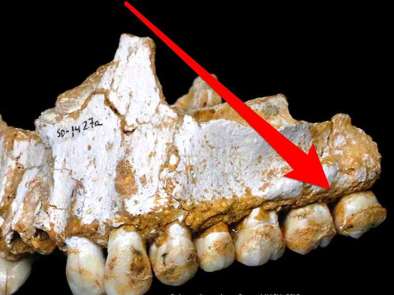 Ancient Plaque On 50000 Year Old Neanderthal Teeth Reveal The Real