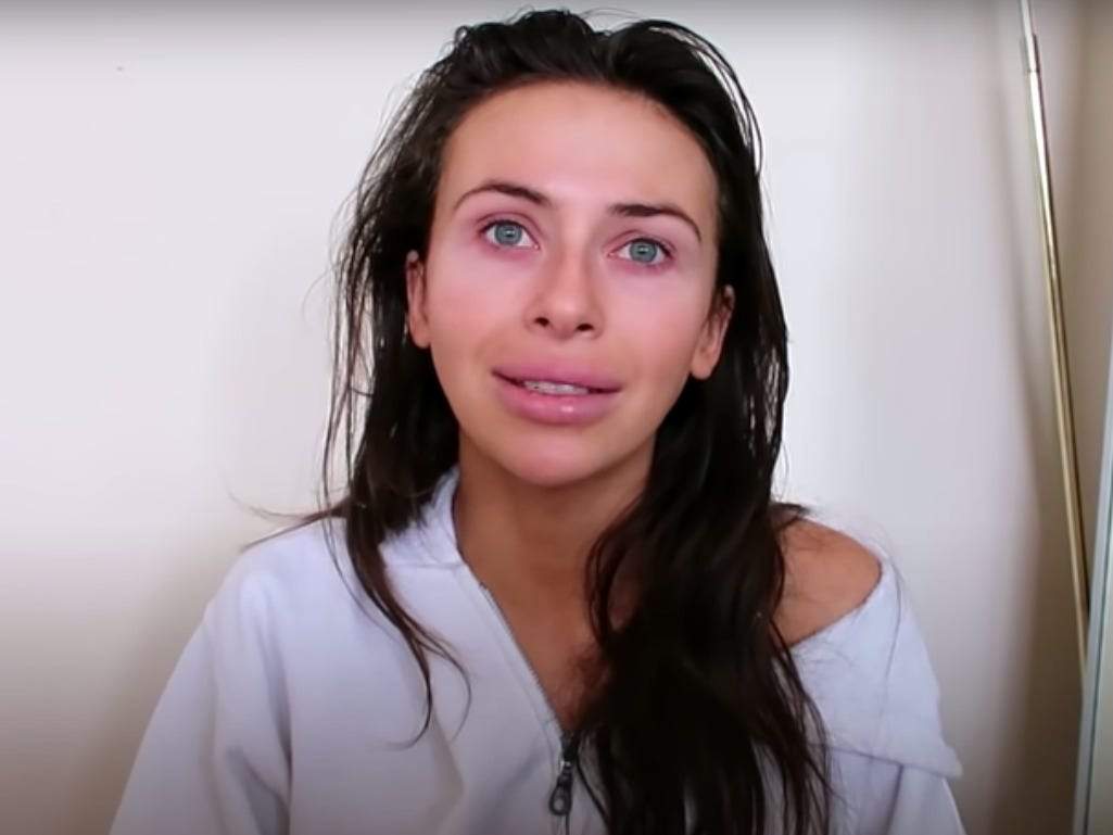 Video Youtuber Shows What It S Like To Have Anxiety And Panic Attacks