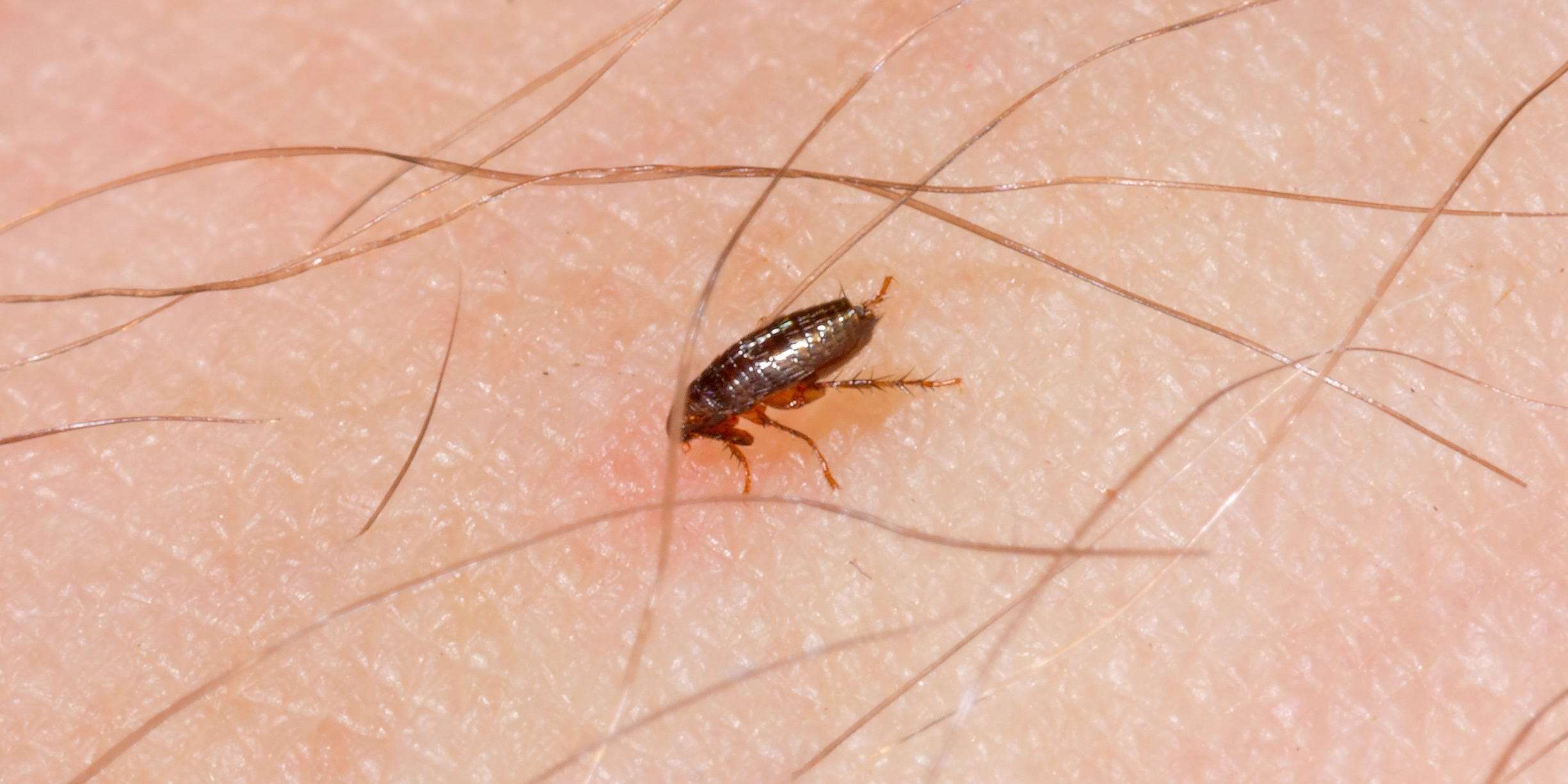 How to treat flea bites and get rid of fleas in your home | Business ...