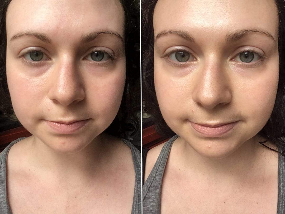 tinted sunscreen before and after