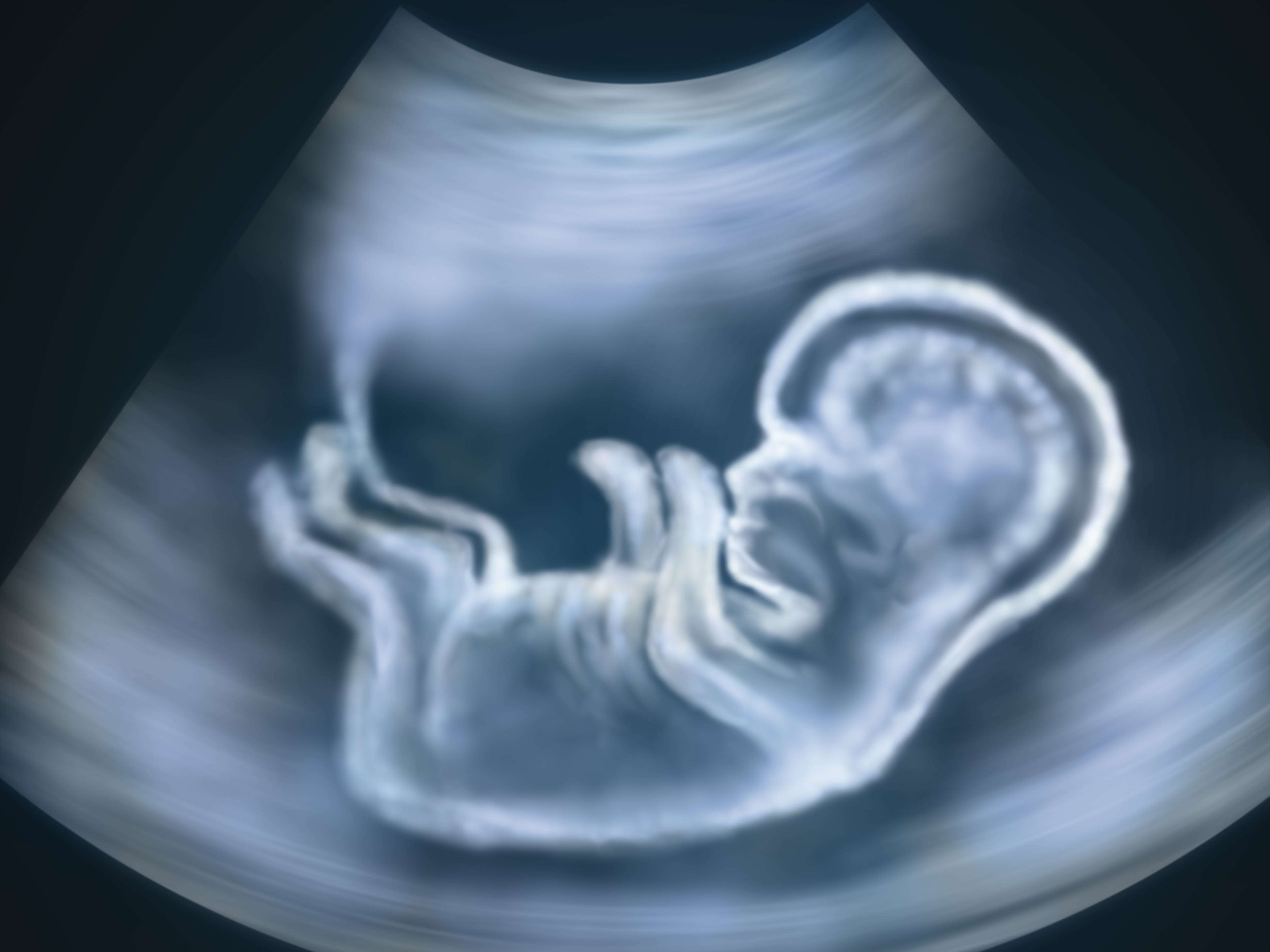 how-many-ultrasounds-during-pregnancy-are-normal-and-what-they-re-for