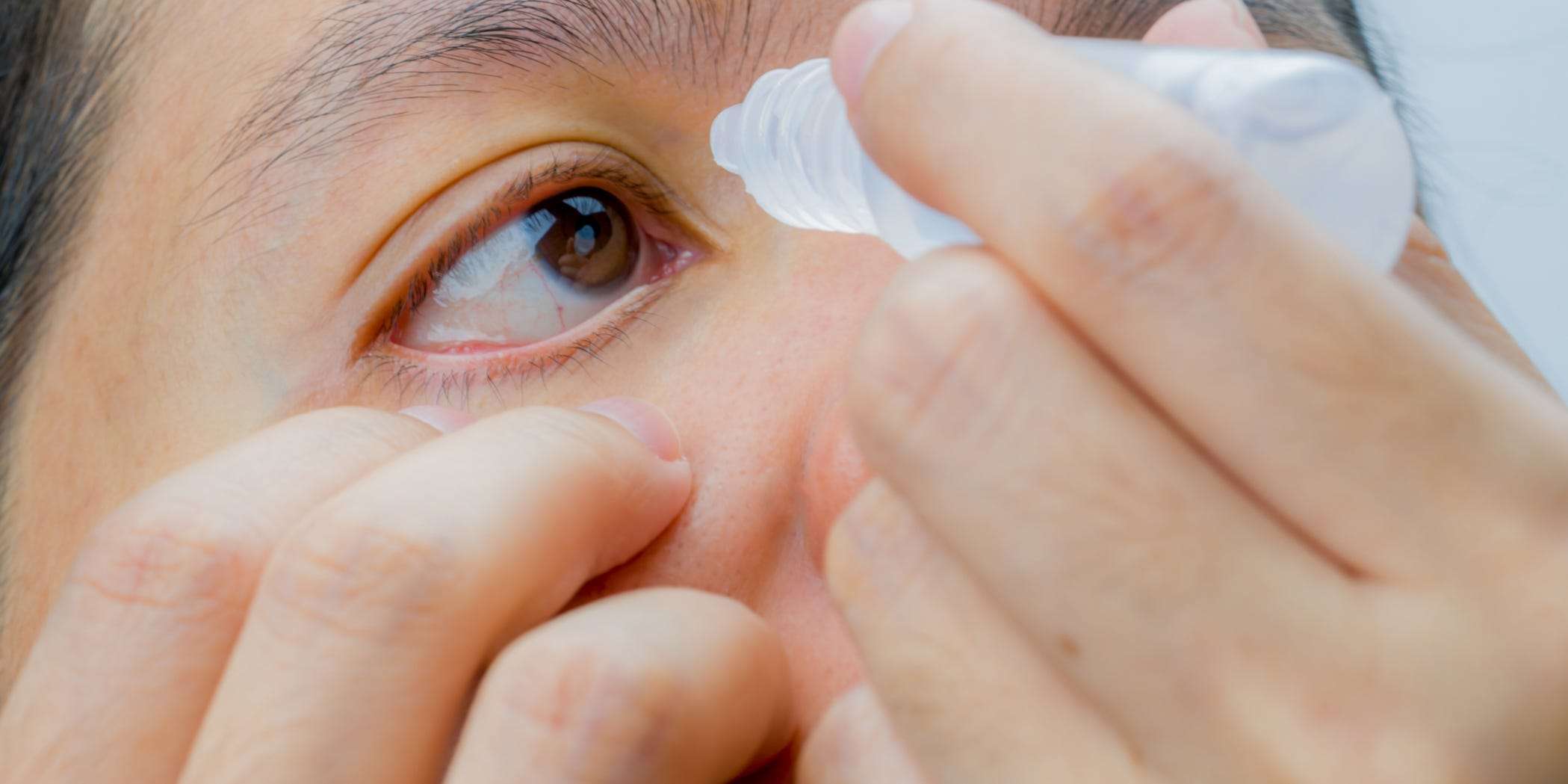 5-home-remedies-to-treat-pink-eye-according-to-eye-doctors-business