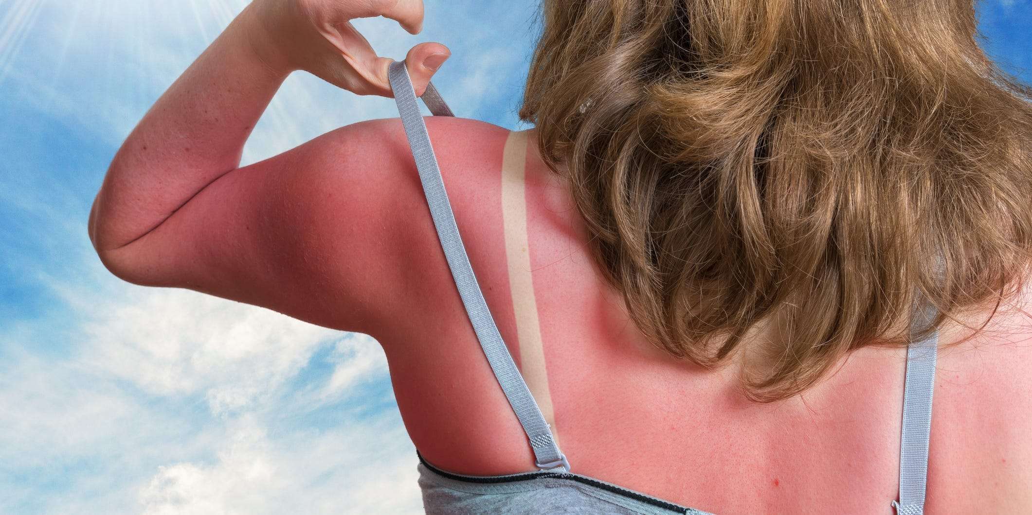 how to not get a sunburn at the beach