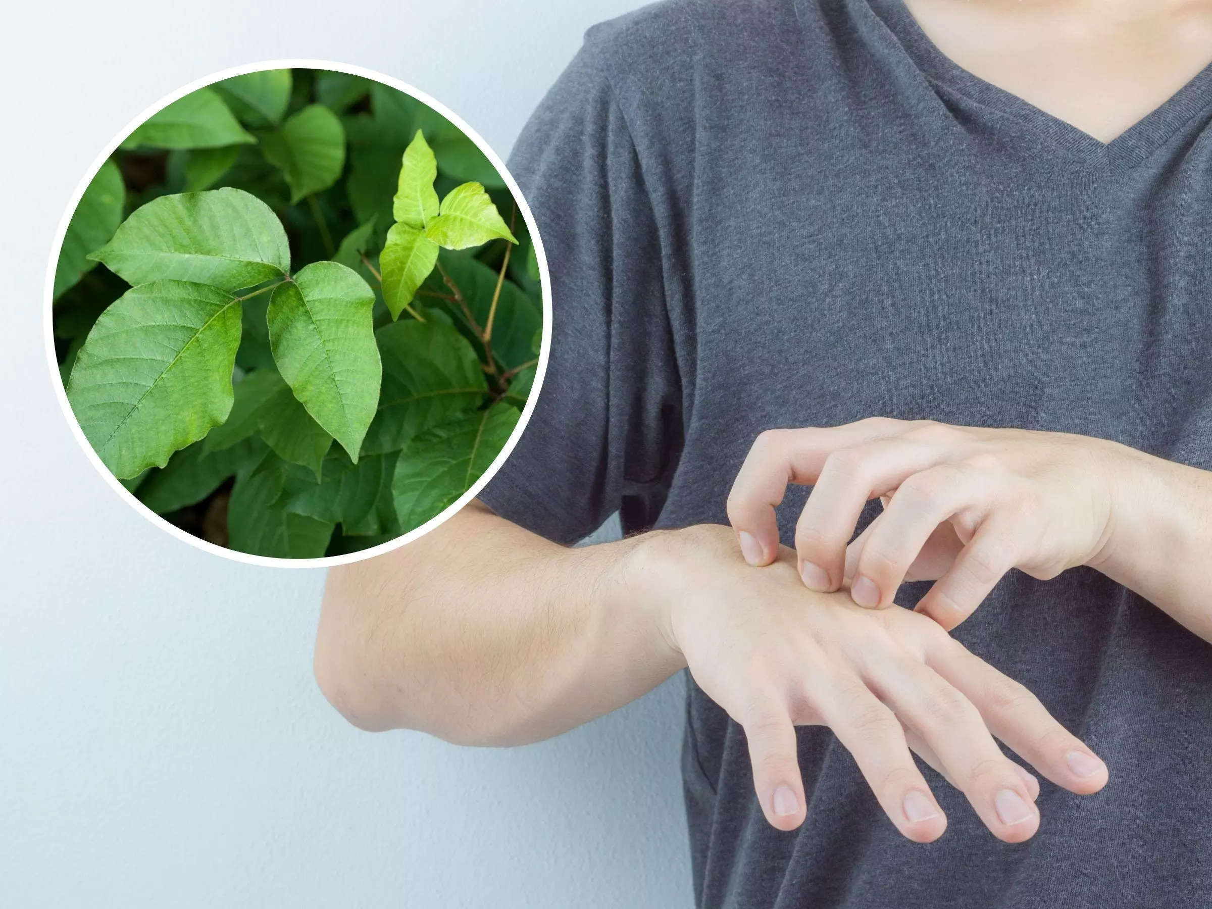 a-man-thought-his-itchy-skin-was-caused-by-a-reaction-to-poison-ivy-he