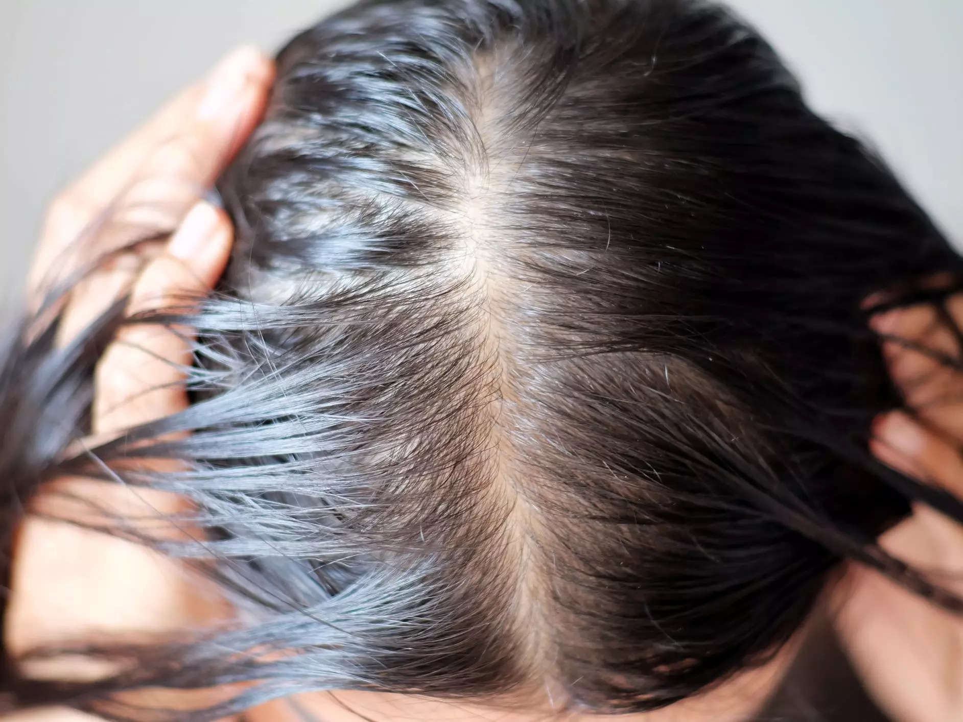 5-surprising-things-that-make-your-hair-fall-out-from-dry-shampoo-to